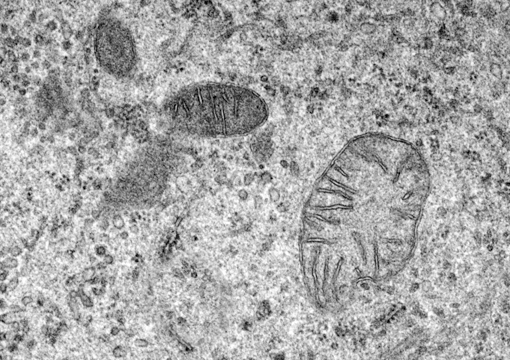 High resolutions TEM training